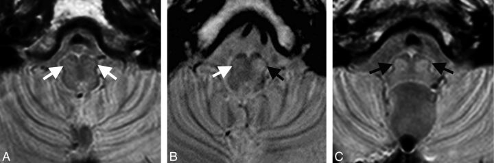 Fig 2.