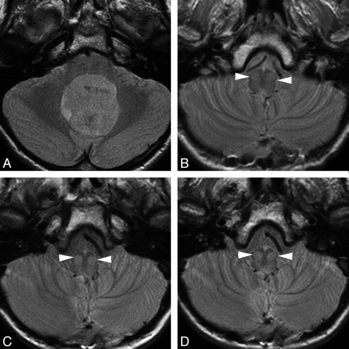 Fig 3.