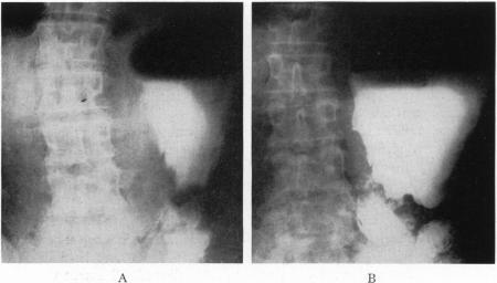 Fig. 2. A,B