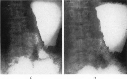 Fig. 2. C,D