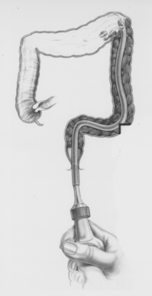 Fig. 7