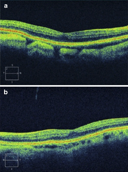 Fig. 2