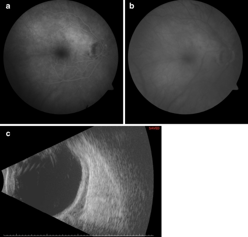 Fig. 1