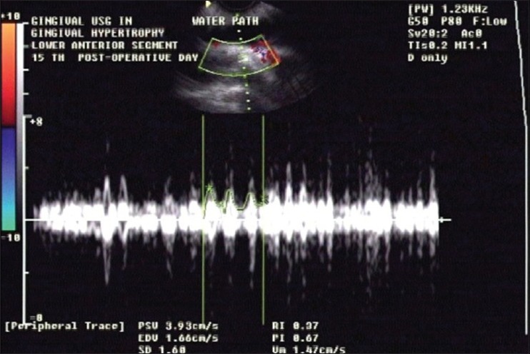 Figure 10b