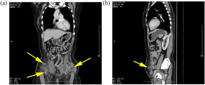 Fig. 2