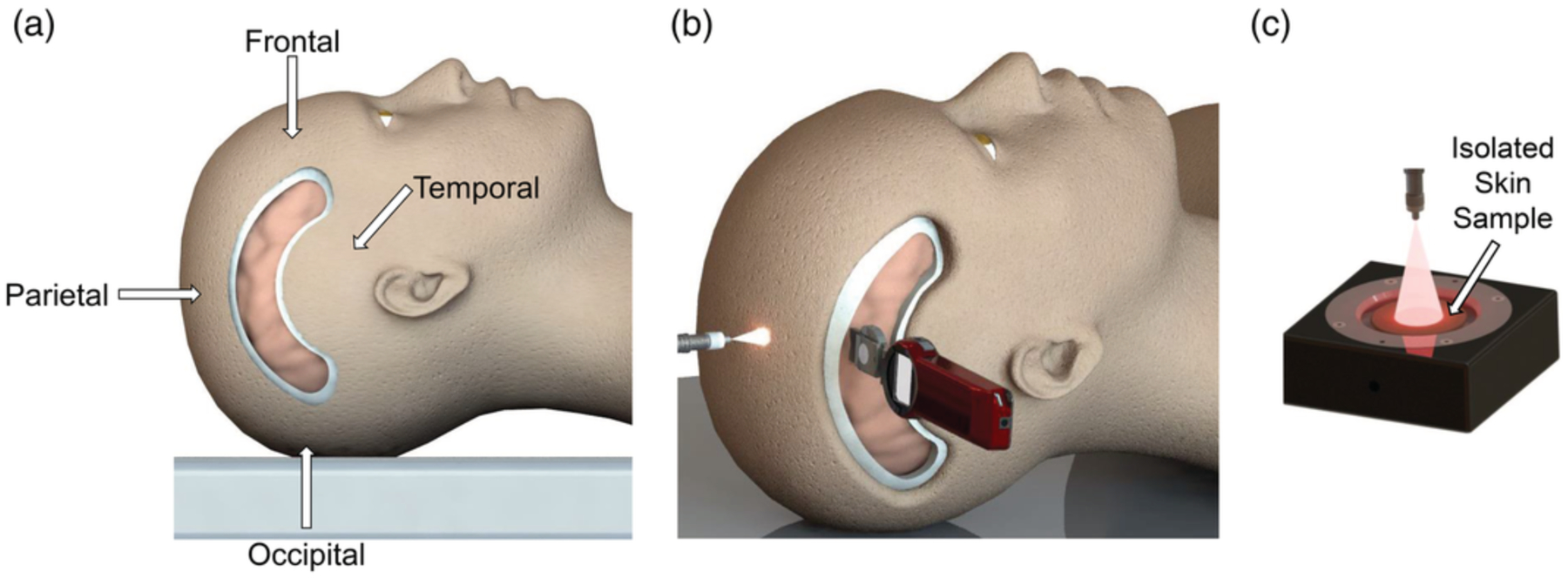 FIGURE 2