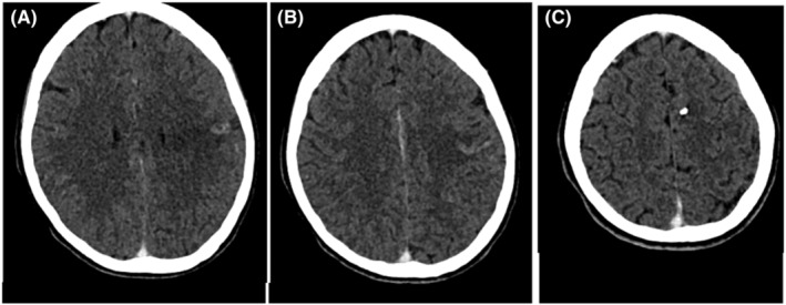 FIGURE 1