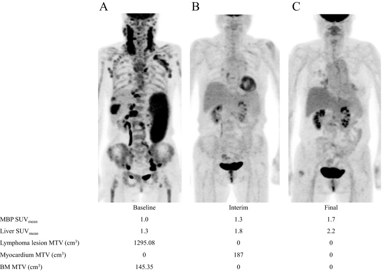 Fig. 2