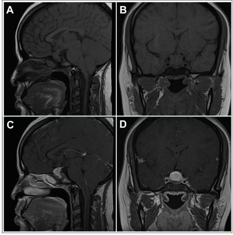 Figure 4: