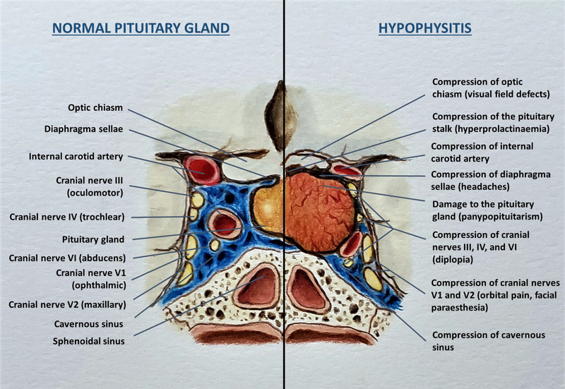 Figure 2: