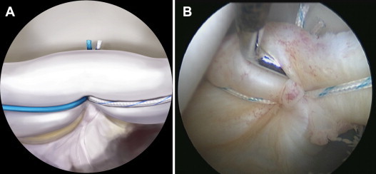 Fig 5