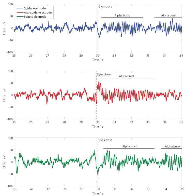 Figure 11