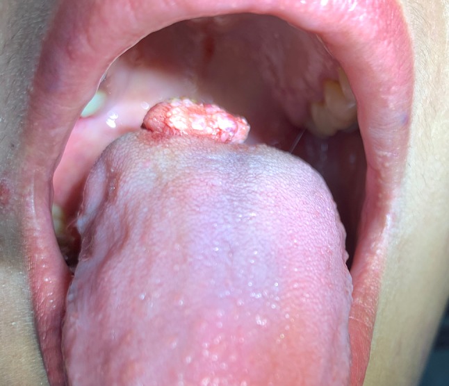Fig. 1