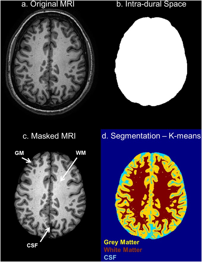 Fig 11