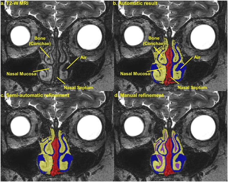 Fig 4