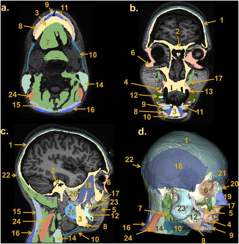 Fig 14