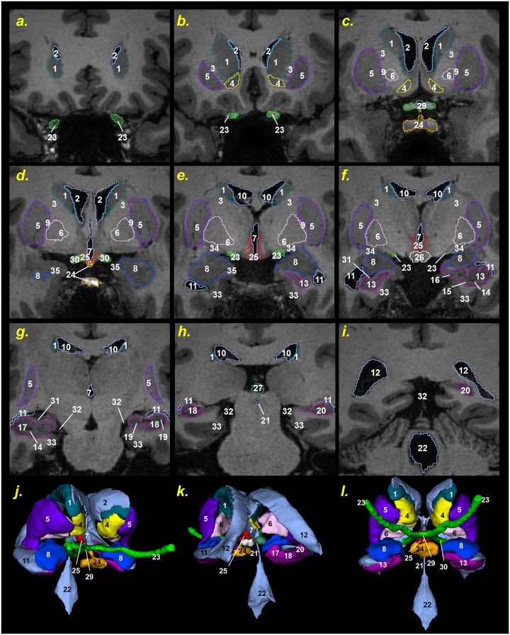 Fig 13