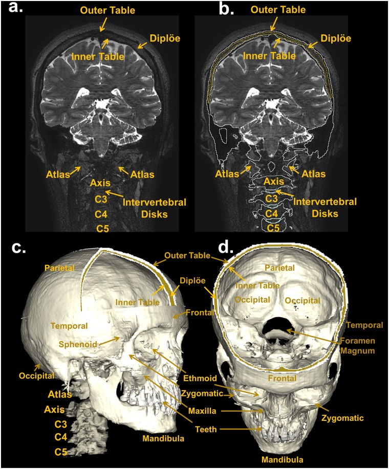 Fig 15