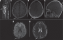 Figure 26