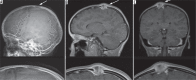 Figure 22