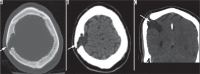 Figure 30