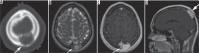 Figure 20