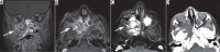 Figure 24