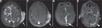 Figure 28