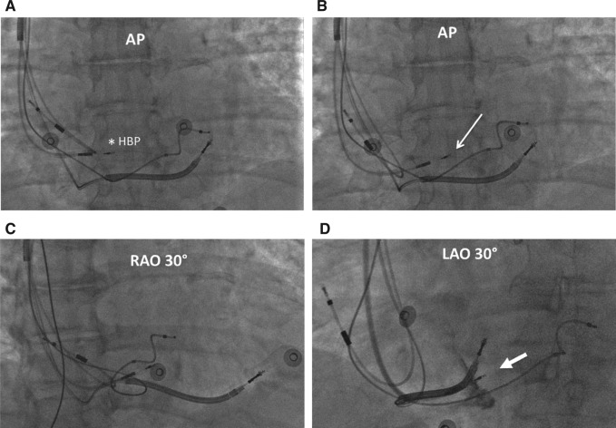 Figure 3: