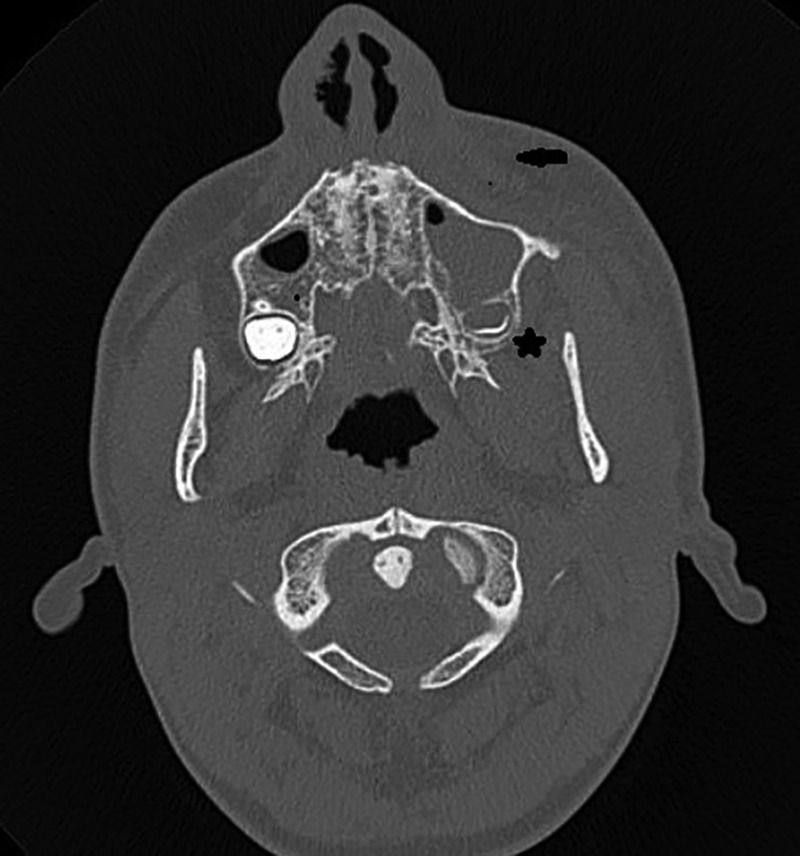 Figure 1