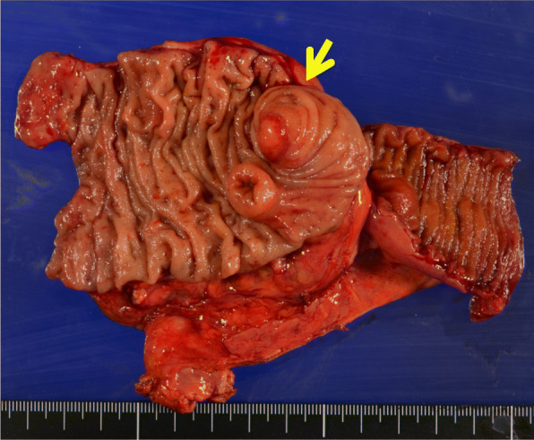 Fig. 4
