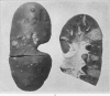 138-1