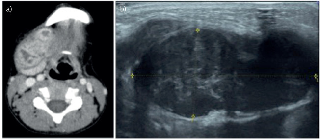 Figure 5