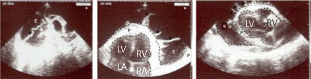 Figure 2