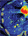 Figure 3b:
