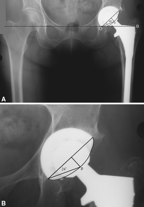 Fig. 3A–B