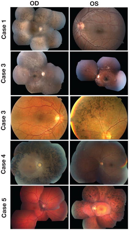 Fig. 1