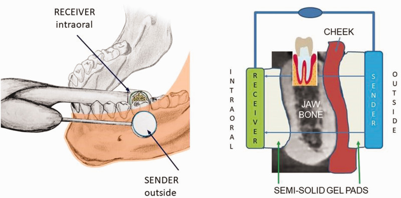 Figure 2.