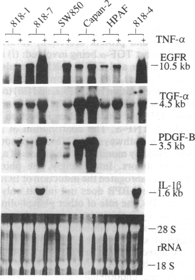 graphic file with name pnas01101-0091-a.jpg