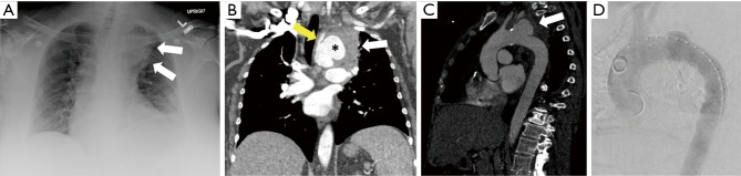 Figure 12