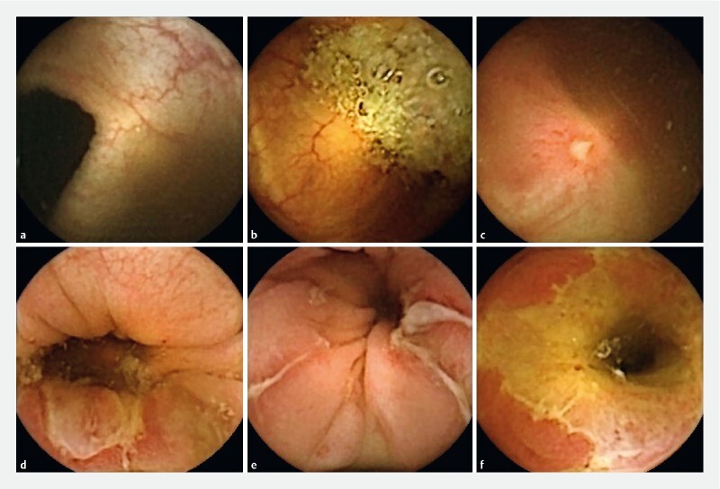 Fig. 1