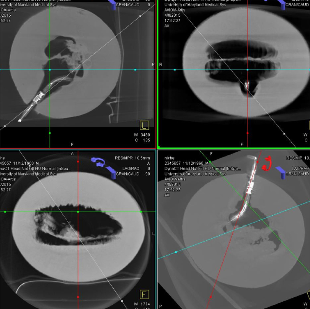 Fig. 14