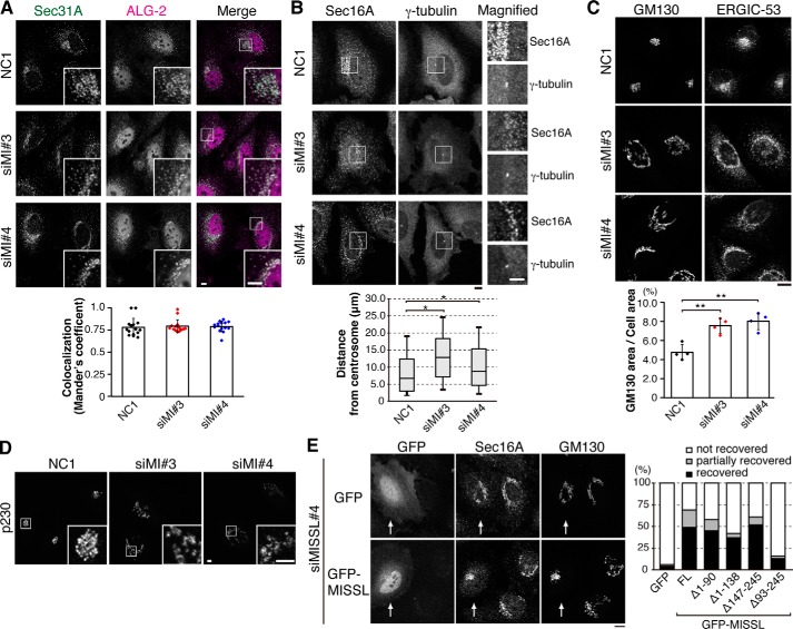 The calcium-binding protein ALG-2 regulates protein secretion and ...