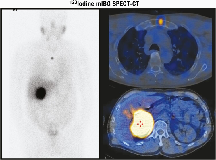 Figure 12.