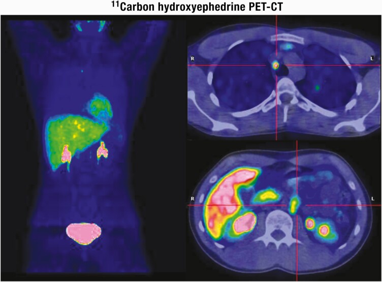 Figure 13.