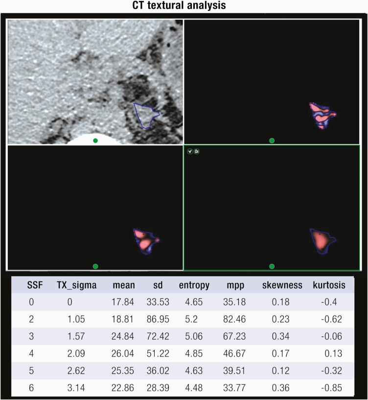 Figure 14.