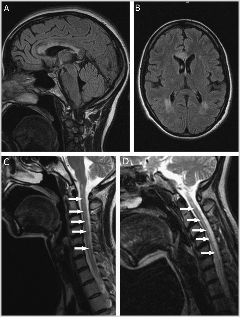 Figure 1-6