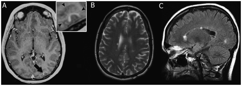 Figure 1-4