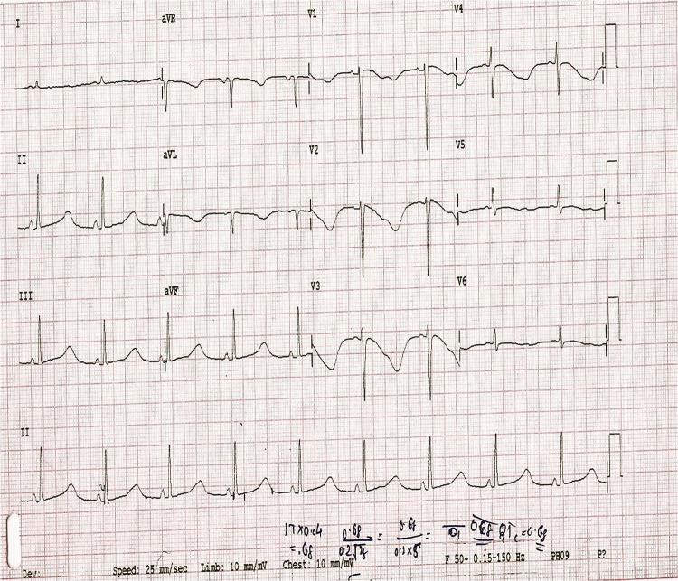 Figure 1