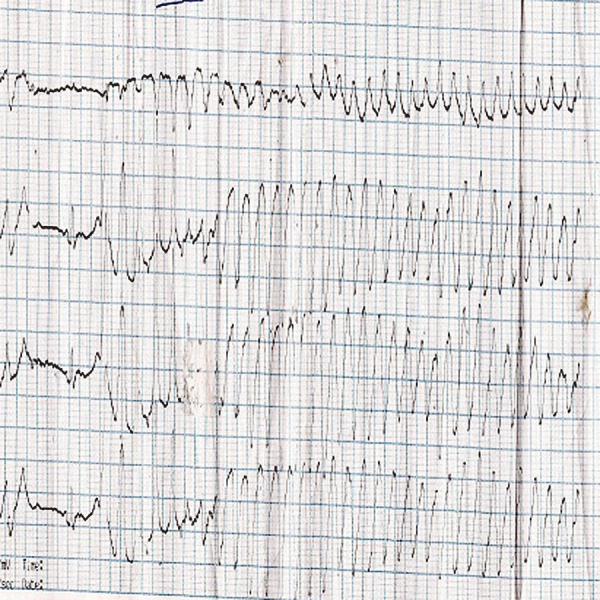 Figure 2